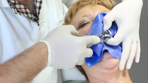 Dentist equipment - dental cure with ultraviolet light equipment - Πλάνα, βίντεο