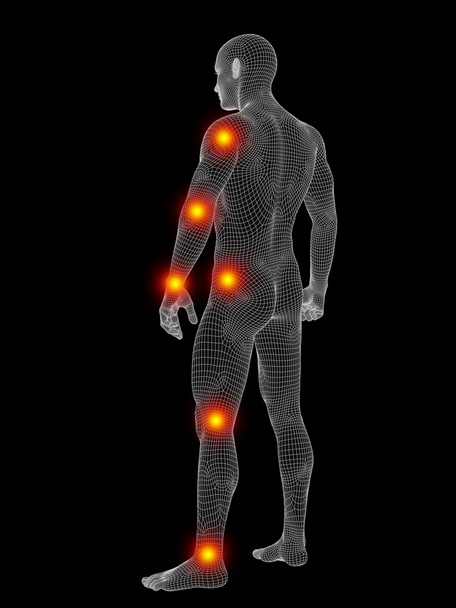drátový model tělo s bolestí - Fotografie, Obrázek