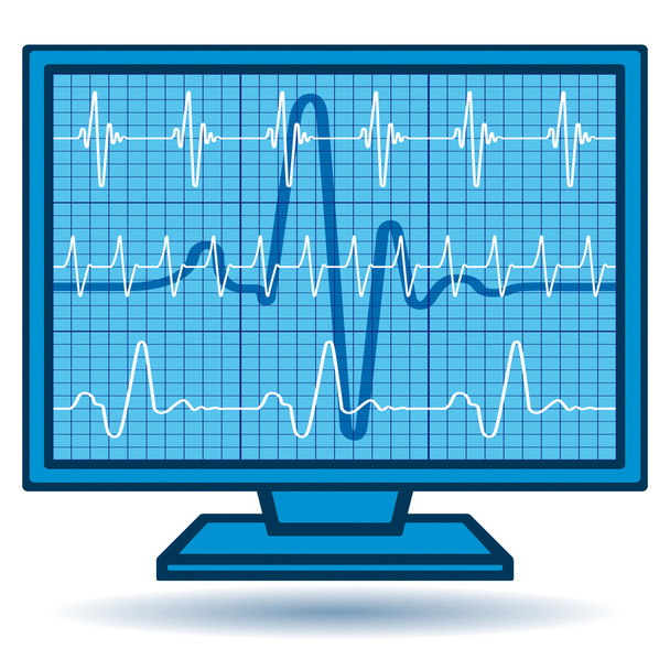 Cardiogram monitor - Vektor, kép