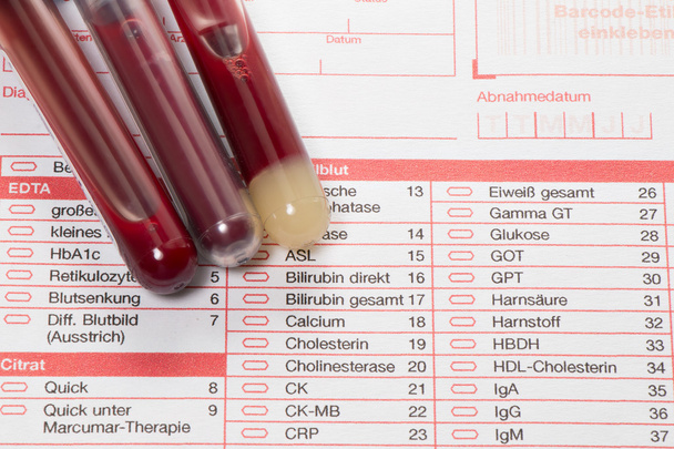 Εξέταση αίματος, δείγματα αίματος σε μια φόρμα εργαστηρίου - Φωτογραφία, εικόνα