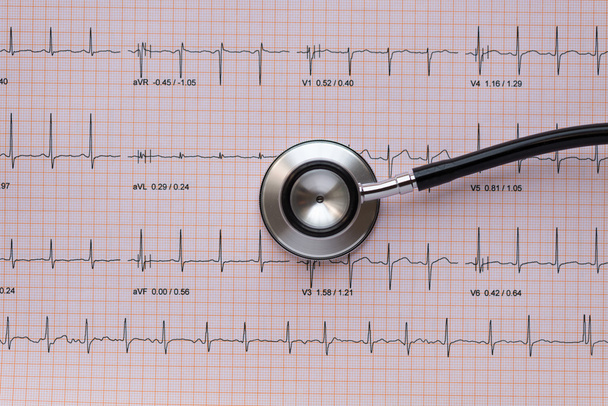 Stethscope sovrastante un ECG o EKG parola medica utile medico w
 - Foto, immagini