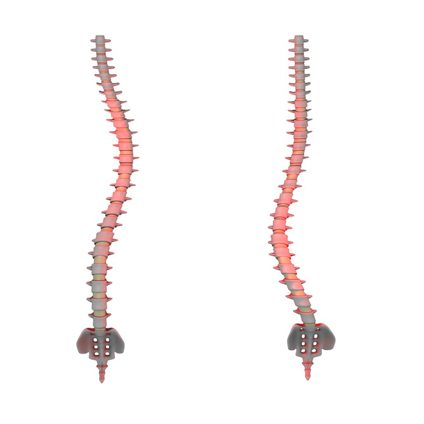 Spine scoliosis - Photo, Image