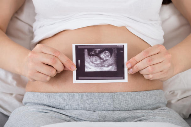 Pregnant Woman With Ultrasound - Fotoğraf, Görsel