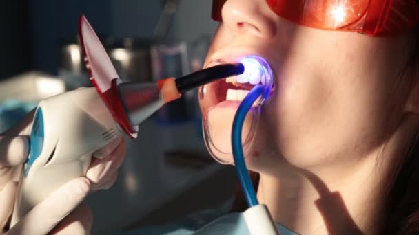 Стоматолог, що працює з лампою стоматологічної полімеризації в ротовій порожнині
. - Кадри, відео