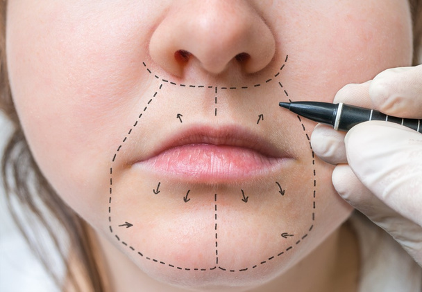 Facial plastic surgery. Hand is drawing lines with marker. - Photo, Image