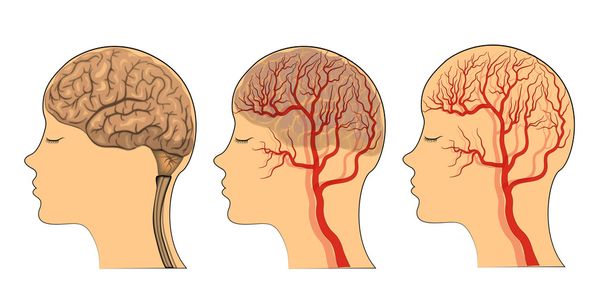 o cérebro, os vasos do cérebro
 - Vetor, Imagem