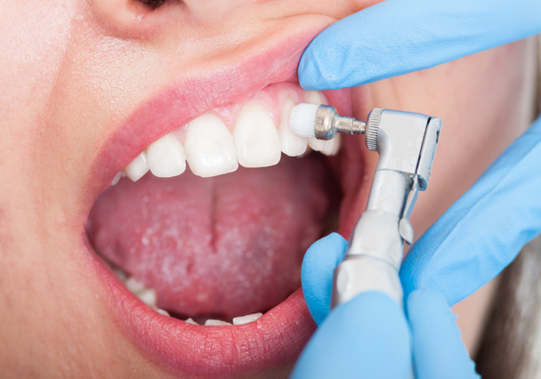Closeup of female patient having teeth examination - Foto, afbeelding