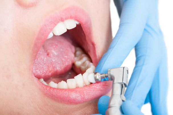Closeup of female patient having dental brush  - Photo, Image