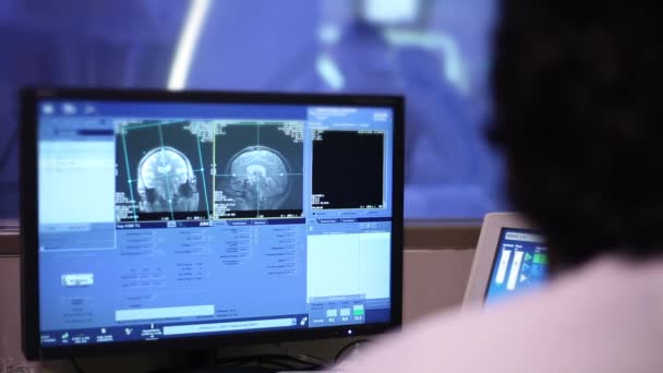 MRI onderzoek. Beeldvorming van de hersenen. Foto's van de hersenscan op de monitor. - Video