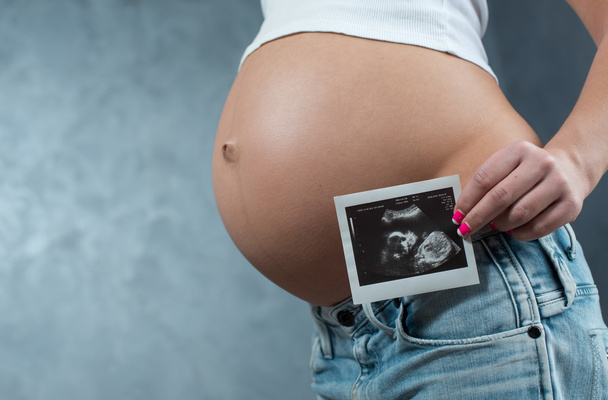 Primo piano di una pancia incinta carina e scansione ad ultrasuoni del bambino. P
 - Foto, immagini