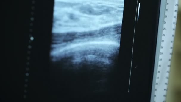 Monitor de ultrasonido en el hospital
 - Imágenes, Vídeo
