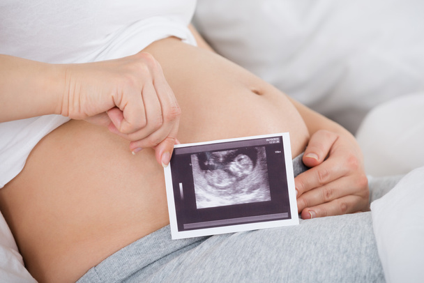 Pregnant Woman With Ultrasound - Fotografie, Obrázek