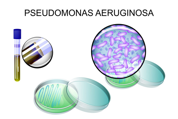 Pseudomonas aeruginosa. bakteriální očkování - Vektor, obrázek