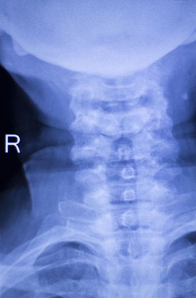 Cráneo cuello columna hombros rayos X escaneo
 - Foto, imagen