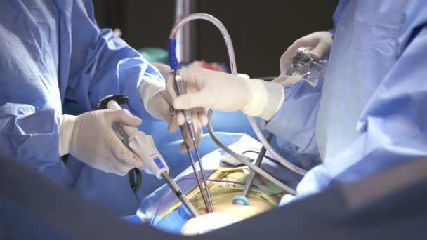 Laparoskopická plicní chirurgii - Záběry, video