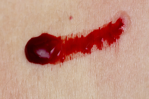 Tratamento de pessoas de sanguessugas médicas
. - Foto, Imagem