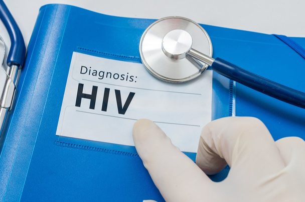 Diagnosi HIV su cartella blu con stetoscopio
. - Foto, immagini