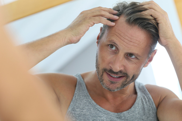 man concerned by hair loss - Fotoğraf, Görsel