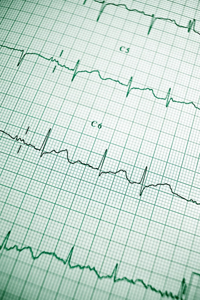 EKG lähikuva
 - Valokuva, kuva