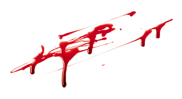 Salpicos de sangue no branco
 - Foto, Imagem