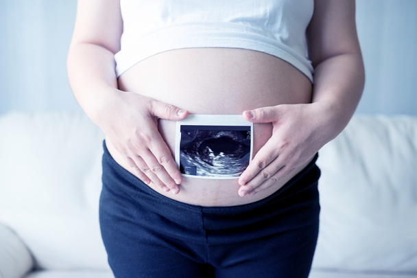 Pregnant woman with ultrasound scan picture  - Zdjęcie, obraz