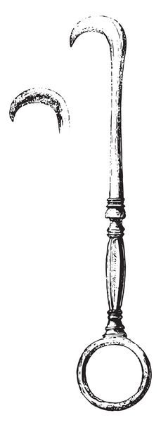 Roman bronze obstetrics instrument, vintage engraving. - Vector, Image