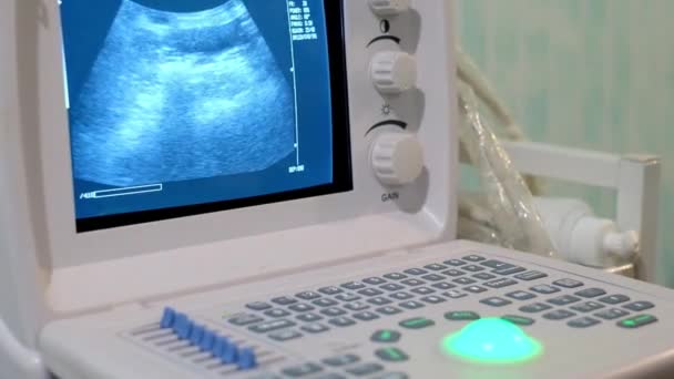 Werken ultrasound medische apparatuur in kliniek - Video