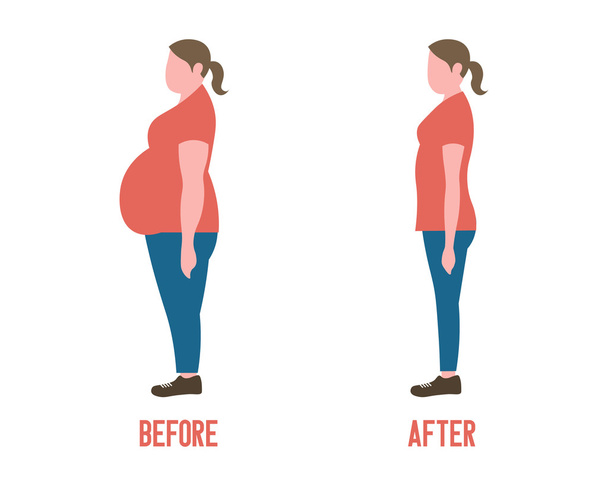 Forma del cuerpo mujeres antes y después de la pérdida de peso
 - Vector, Imagen
