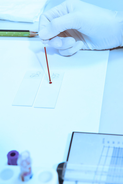 blood testing in laboratory - Foto, Imagen