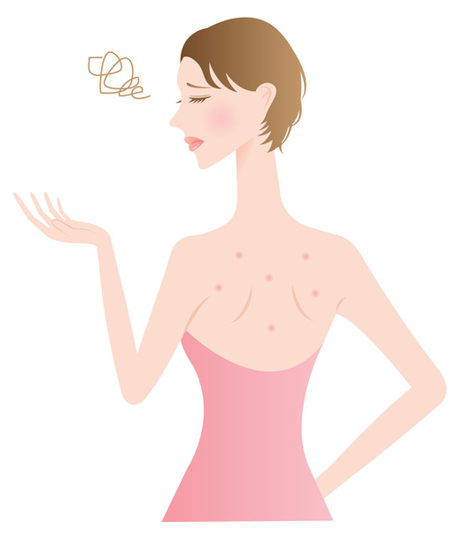 back pimple woman - Vector, Image