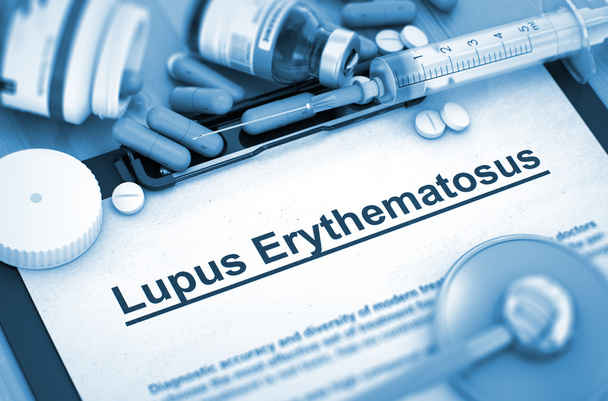 Lupus Erythematosus Diagnosis. Medical Concept. - Photo, Image