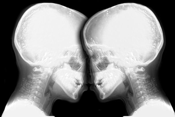 two skeleton face to face - Photo, Image