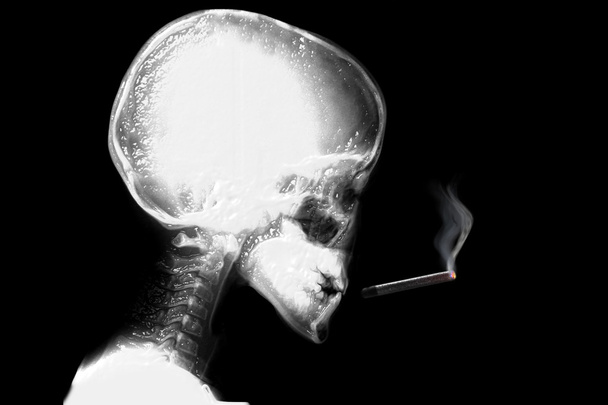 σκελετός σταματήσουν το κάπνισμα - Φωτογραφία, εικόνα
