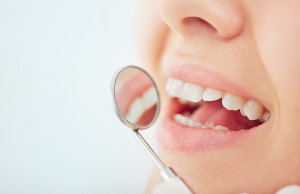 open mouth during oral checkup - Φωτογραφία, εικόνα