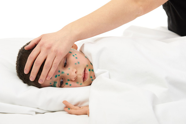 bambino malato ha il virus sulla pelle
 - Foto, immagini