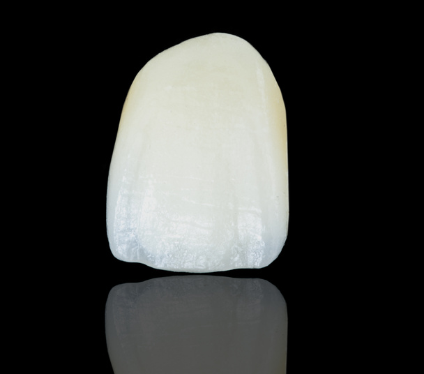 Κεραμικές οδοντιατρικές κορώνες χωρίς μέταλλα - Φωτογραφία, εικόνα