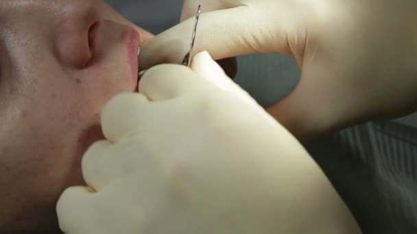dentist makes a mold of teeth - Materiaali, video