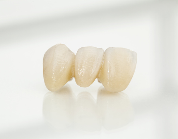 Metal free ceramic dental crowns - Фото, изображение