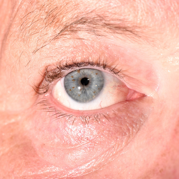 kaukaski oka podczas badania oka. - Zdjęcie, obraz