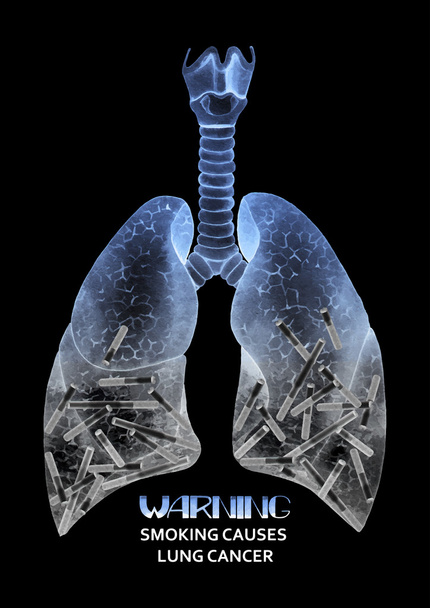 Pulmones de acuarela llenos de cigarrillos
 - Vector, Imagen