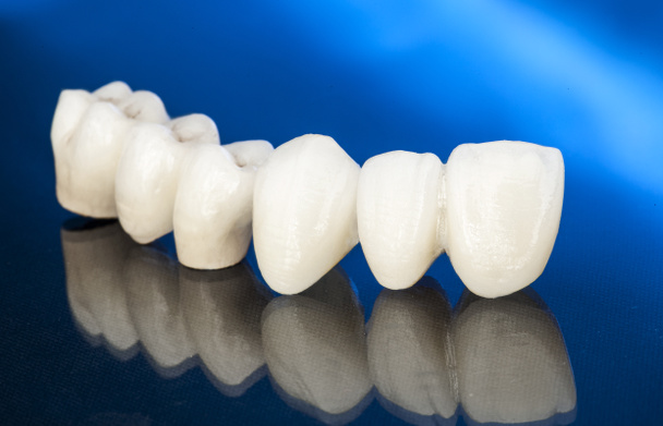 Κεραμικές οδοντιατρικές κορώνες χωρίς μέταλλα - Φωτογραφία, εικόνα