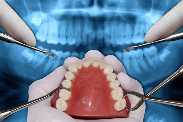 ortodoncie nástroje pro chirurgii simulace - Fotografie, Obrázek