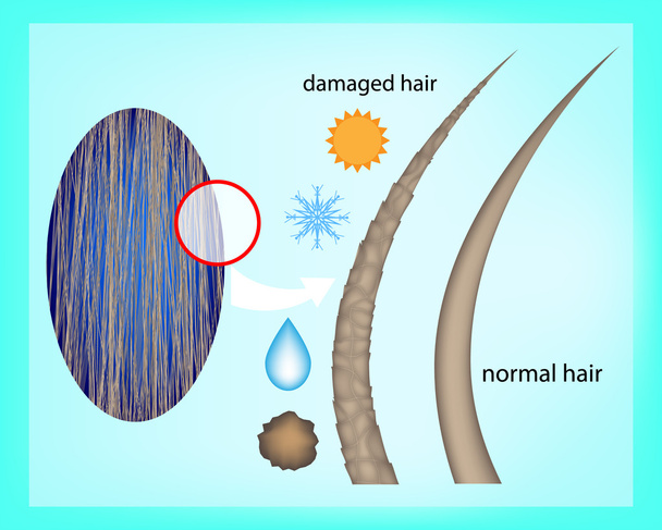 Εσωτερικών και εξωτερικών παραγόντων που επηρεάζουν την υγεία των μαλλιών. Ιατρική φροντίδα των μαλλιών. Πριν και μετά τη θεραπεία μαλλιών. Μαλλιά φροντίδα έννοια. Ταλαιπωρημένα μαλλιά και κανονικά μαλλιά - Διάνυσμα, εικόνα