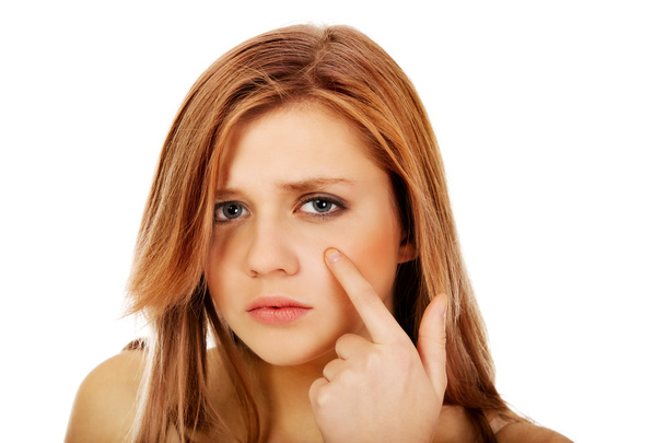 Teenage woman pointing on pimple on her cheek - Fotó, kép