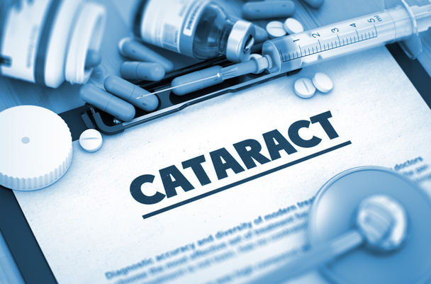 Cataract Diagnosis. Medical Concept. 3D. - Foto, Bild