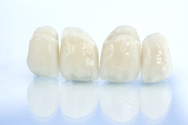 Coronas dentales de cerámica sin metal - Foto, imagen