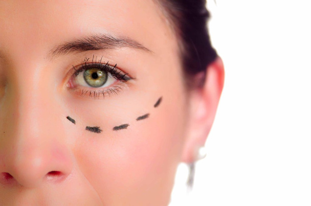 Fechar metade da cara mulher caucasiana com linhas pontilhadas desenhadas em torno do olho esquerdo, preparando cirurgia estética
 - Foto, Imagem