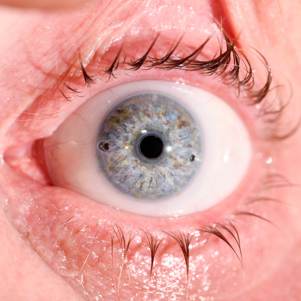 post traumatic at eye test - Photo, Image