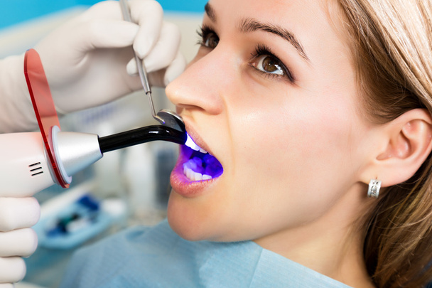 The reception was at the female dentist. Doctor examines the oral cavity on tooth decay. Caries protection. Tooth decay treatment. Dentist working with dental polymerization lamp in oral cavity - Φωτογραφία, εικόνα