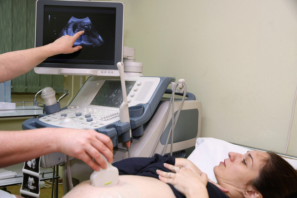 Pregnant woman and doctor hand's with ultrasound equipment durin - Photo, Image
